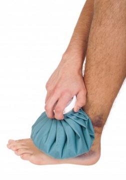 Ankle Sprains